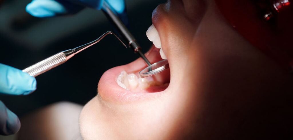 Kiedy aparat ortodontyczny jest koniecznością?